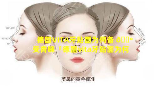 德国VITA牙贴面为何备 🌺 受青睐「德国vita牙贴面为何备 🐟 受青睐」